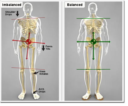 Short Leg Syndrome or Leg Length Inequality - Levin and Chellen