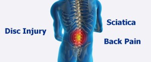 disc injury, disk herniation, sciatica, back pain