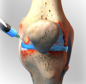 knee-injection-resized_0